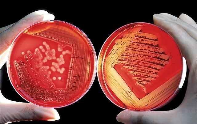OMS anuncia grupo que estudará novos vírus e bactérias que podem causar doenças