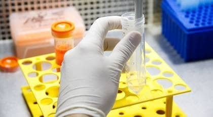 Cientistas apostam em abordagens inovadoras na busca de vacinas contra dengue e zika